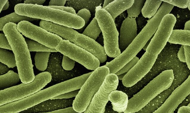 koli bacteria, escherichia coli, bacteria, disease, pathogens, microscopy, electron microscopy, electron microscope, vaccination, immune system, diseases, vaccine, escherichia, infect, infection, risk of infection, pathogen, viruses, bacteria, bacteria, bacteria, bacteria, bacteria