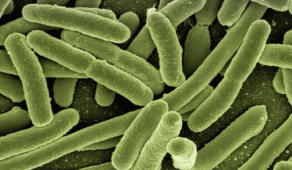 koli bacteria, escherichia coli, bacteria, disease, pathogens, microscopy, electron microscopy, electron microscope, vaccination, immune system, diseases, vaccine, escherichia, infect, infection, risk of infection, pathogen, viruses, bacteria, bacteria, bacteria, bacteria, bacteria